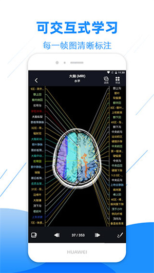 影像解剖图谱app永久免费会员版软件特色截图