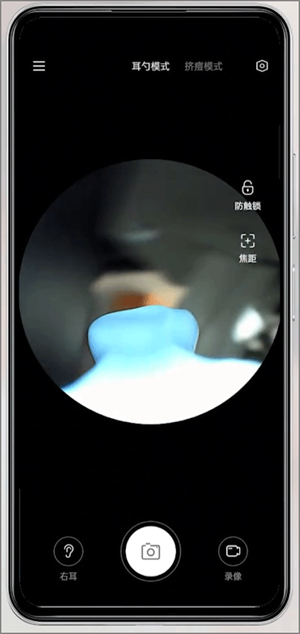 XLife智能可视采耳棒app怎么连接设备截图4