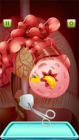 外科医生手术模拟器汉化版最新版新手指南截图6