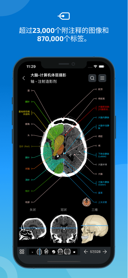 e-Anatomy中文免费版下载 第2张图片