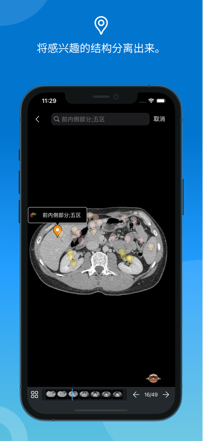 e-Anatomy中文免费版下载 第3张图片