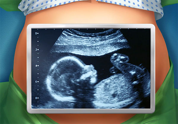 医院手术时间游戏汉化版 第3张图片